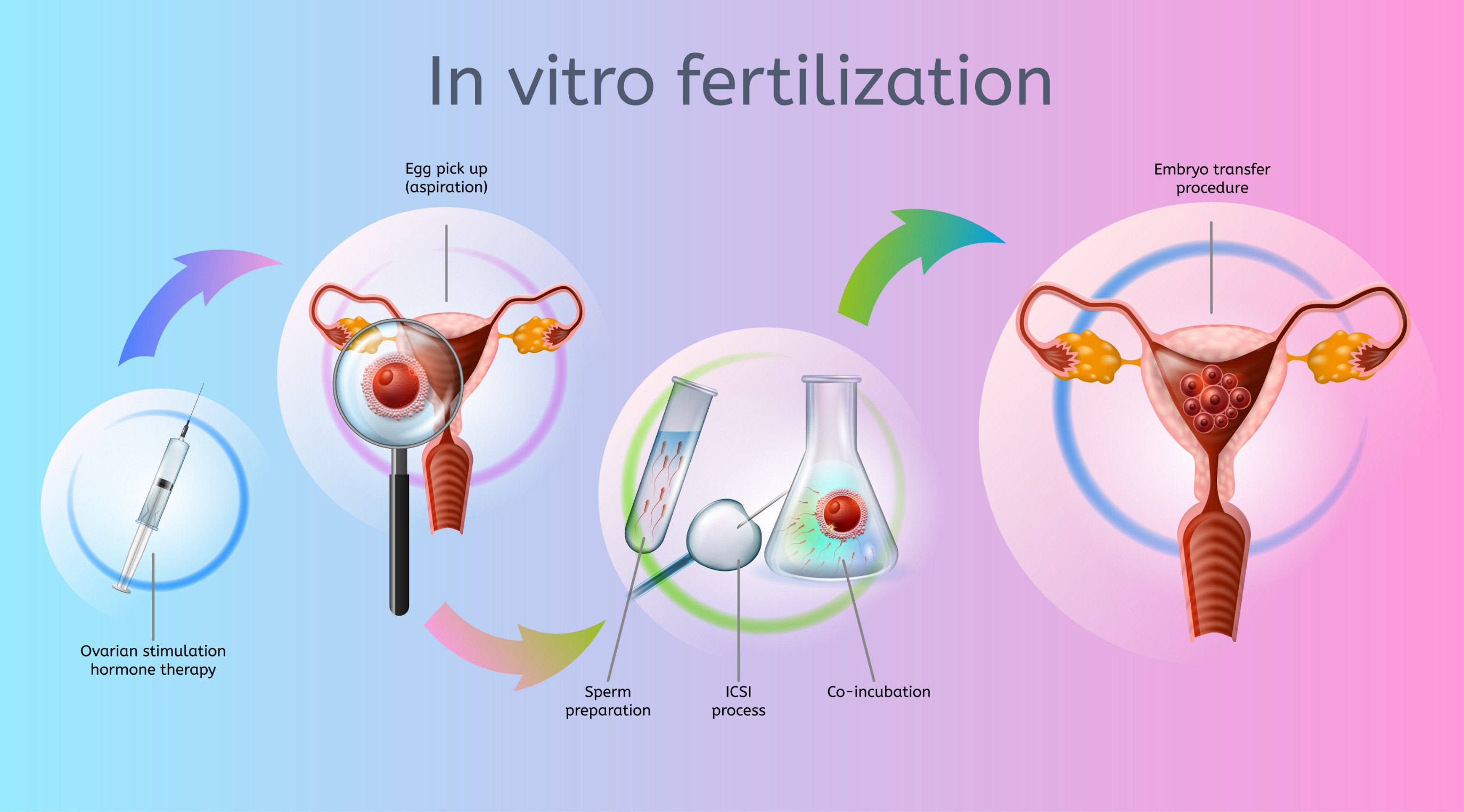 Fécondation in vitro